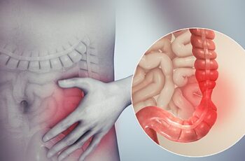 7 Foods That Can Make Your IBS Worse